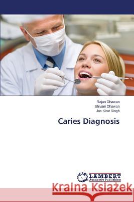Caries Diagnosis Dhawan Rajan                             Singh Jas Kirat 9783659379413 LAP Lambert Academic Publishing - książka