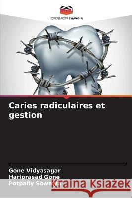 Caries radiculaires et gestion Gone Vidyasagar Hariprasad Gone Potpally Sowmya 9786206075301 Editions Notre Savoir - książka