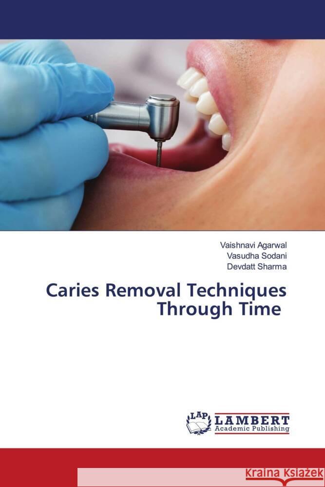 Caries Removal Techniques Through Time Vaishnavi Agarwal Vasudha Sodani Devdatt Sharma 9786207484287 LAP Lambert Academic Publishing - książka