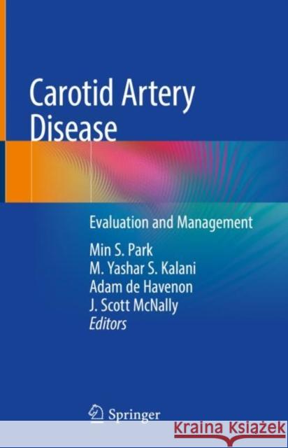 Carotid Artery Disease: Evaluation and Management Park, Min S. 9783030411374 Springer - książka