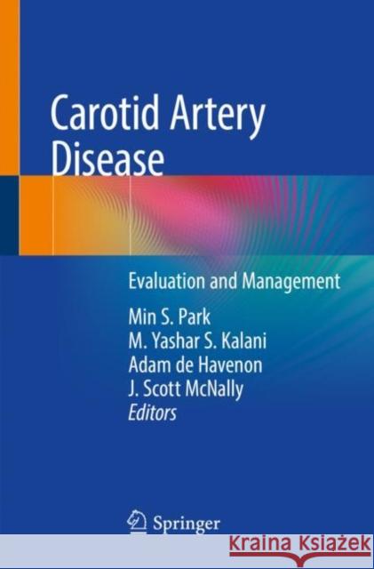 Carotid Artery Disease: Evaluation and Management Min S. Park M. Yashar S. Kalani Adam d 9783030411404 Springer - książka