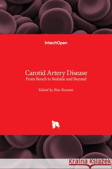 Carotid Artery Disease: From Bench to Bedside and Beyond Rita Rezzani 9789535112143 Intechopen - książka