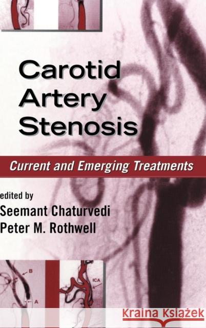Carotid Artery Stenosis: Current and Emerging Treatments Chaturvedi, Seemant 9780824754174 Taylor & Francis Group - książka