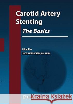 Carotid Artery Stenting: The Basics Jacqueline Saw 9781603273138  - książka