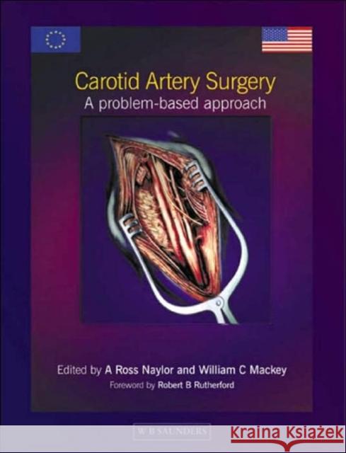Carotid Artery Surgery : A Problem-based Approach Naylor, A. Ross, Mackey, William C. 9780702024320 Saunders Ltd. - książka
