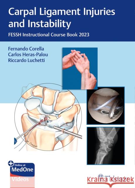 Carpal Ligament Injuries and Instability  9783132451896 Thieme Publishing Group - książka