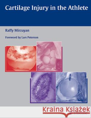 Cartilage Injury in the Athlete Raffy Mirzayan Lars Peterson 9781588903051 Thieme Medical Publishers - książka