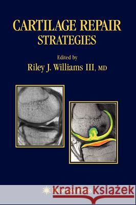 Cartilage Repair Strategies Riley J., III Williams Lars Peterson Brian J. Cole 9781588296290 Humana Press - książka