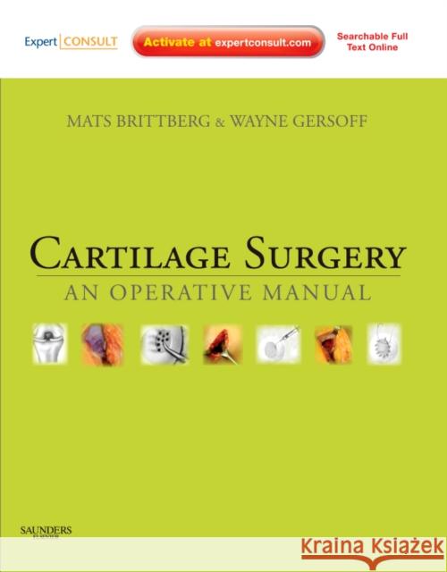 Cartilage Surgery : An Operative Manual, Expert Consult: Online and Print Mats Brittberg 9781437708783 SAUNDERS - książka