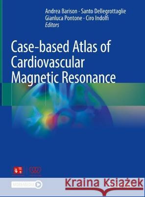 Case-based Atlas of  Cardiovascular Magnetic Resonance  9783031325922 Springer International Publishing - książka