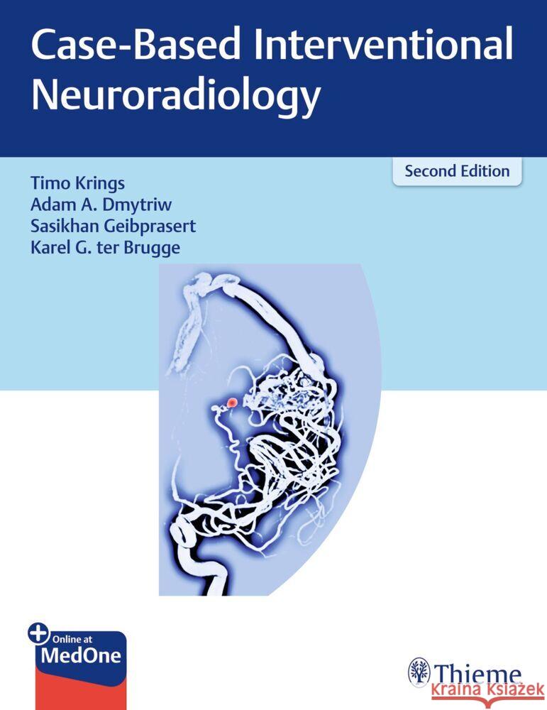 Case-Based Interventional Neuroradiology Karel ter Brugge 9781684200702 Thieme Medical Publishers Inc - książka