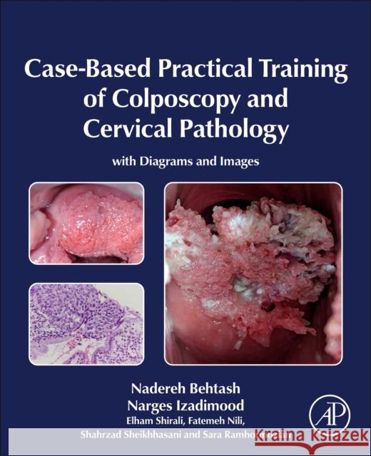 Case-Based Practical Training of Colposcopy and Cervical Pathology: With Diagrams and Images Nadereh Behtash Narges Izadimood Elham Shirali 9780443247941 Academic Press - książka
