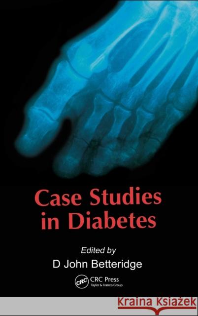 Case Studies in Diabetes John D. Betteridge D. John Betteridge Betteridge John Betteridge 9781841840321 Taylor & Francis Group - książka