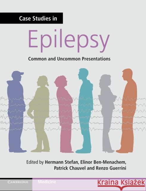 Case Studies in Epilepsy: Common and Uncommon Presentations Stefan, Hermann 9780521167123 CAMBRIDGE UNIVERSITY PRESS - książka