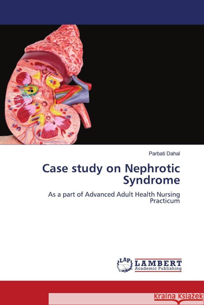Case study on Nephrotic Syndrome Dahal, Parbati 9786204987071 LAP Lambert Academic Publishing - książka