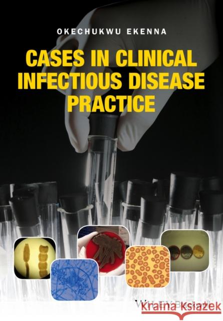 Cases in Clinical Infectious Disease Practice Okechukwu Ekenna 9781119044161 Wiley-Blackwell - książka