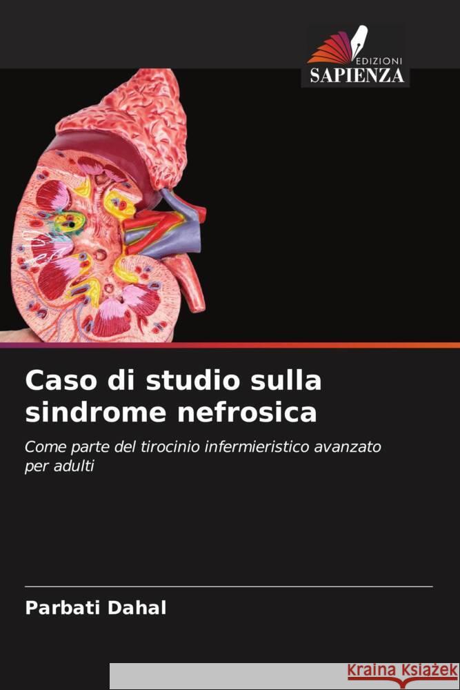 Caso di studio sulla sindrome nefrosica Dahal, Parbati 9786205078327 Edizioni Sapienza - książka
