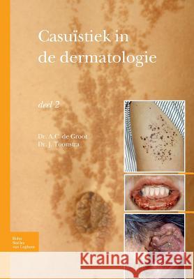 Casuïstiek in de Dermatologie - Deel 2 Toonstra, Johan 9789031384570 Bohn Stafleu Van Loghum - książka