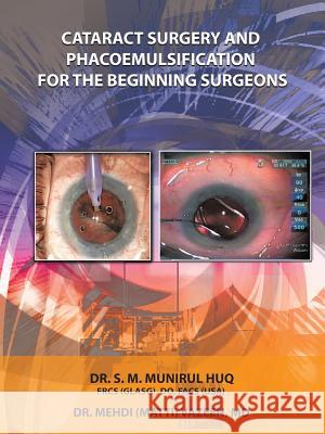 Cataract Surgery And Phacoemulsification For The Beginning Surgeons Dr S. M. Munirul Huq Dr Mehdi Vazeen 9781496944139 Authorhouse - książka