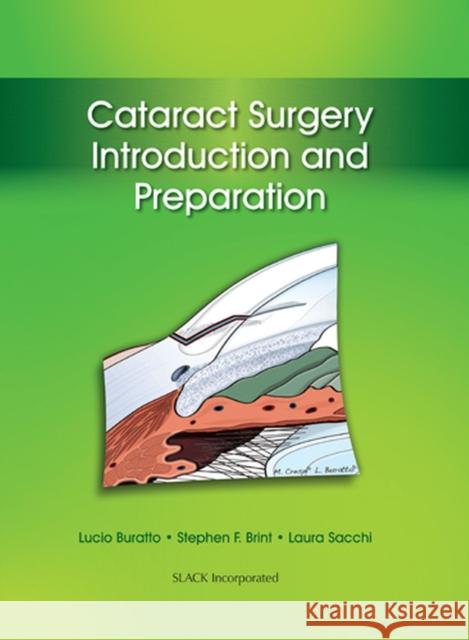 Cataract Surgery: Introduction and Preparation Buratto, Lucio 9781617116056 Slack - książka