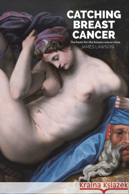 Catching Breast Cancer Lawson, James 9781398447820 AUSTIN MACAULEY PUBLISHERS LTD - książka