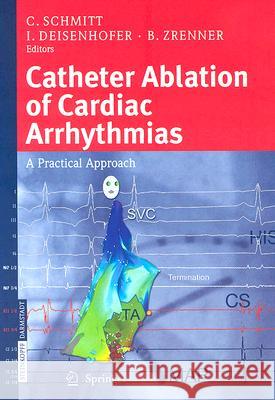 Catheter Ablation of Cardiac Arrhythmias: A Practical Approach C. Schmitt I. Deisenhofer B. Zrenner 9783798515758 Springer - książka