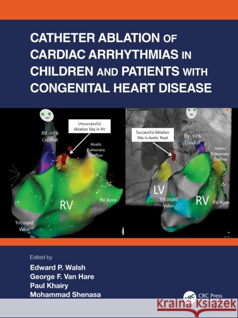 Catheter Ablation of Cardiac Arrhythmias in Children and Patients with Congenital Heart Disease Edward P. Walsh George F. Van Hare Paul Khairy 9780367534523 CRC Press - książka