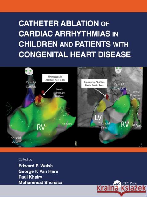 Catheter Ablation of Cardiac Arrhythmias in Children and Patients with Congenital Heart Disease Edward P. Walsh George F. Van Hare Paul Khairy 9780367534752 CRC Press - książka