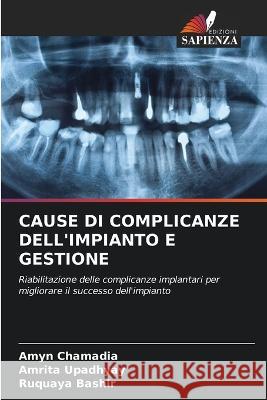 Cause Di Complicanze Dell'impianto E Gestione Amyn Chamadia Amrita Upadhyay Ruquaya Bashir 9786206013440 Edizioni Sapienza - książka