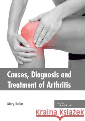 Causes, Diagnosis and Treatment of Arthritis Mary Kellar 9781632414465 Hayle Medical - książka