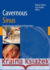 Cavernous Sinus: Developments and Future Perspectives Vinko V. Dolenc Larry Rogers 9783211999011 Not Avail - książka