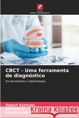 CBCT - Uma ferramenta de diagn?stico Rajesh Kashyap Johnvee S Shashikanth Hegde 9786207512867 Edicoes Nosso Conhecimento - książka