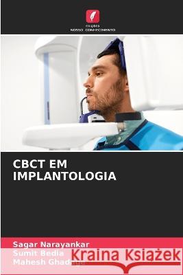 Cbct Em Implantologia Sagar Narayankar Sumit Bedia Mahesh Ghadage 9786205990018 Edicoes Nosso Conhecimento - książka