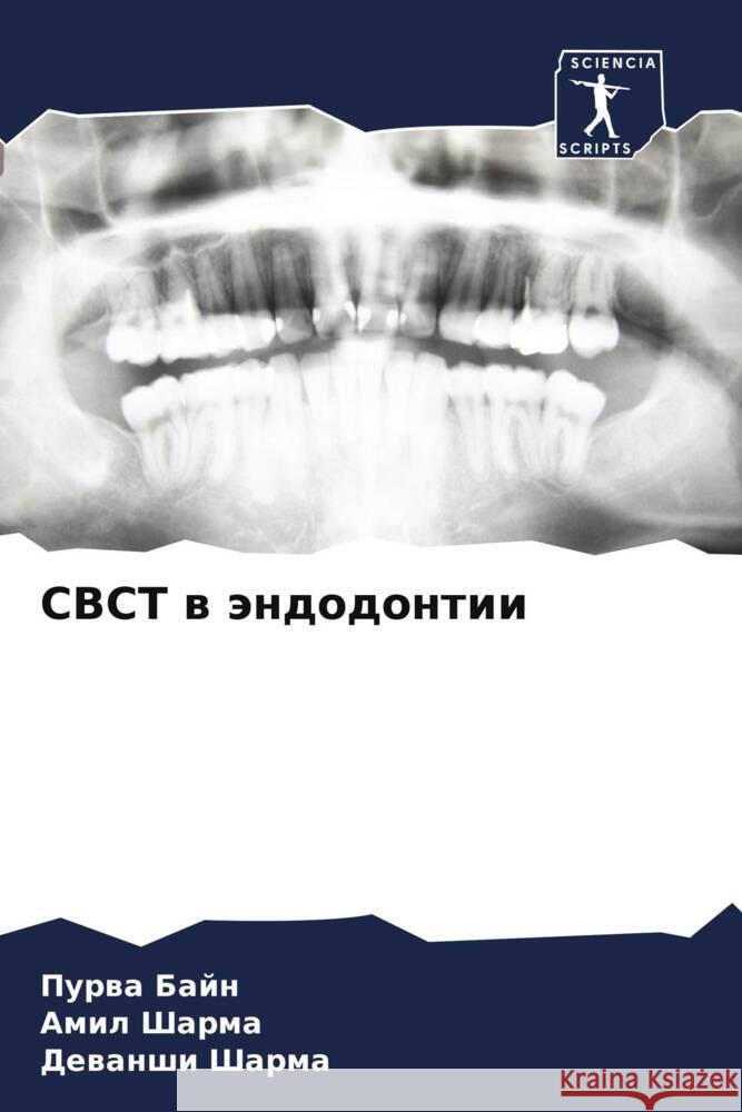 CBCT w ändodontii Bajn, Purwa, Sharma, Amil, Sharma, Dewanshi 9786205156384 Sciencia Scripts - książka