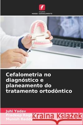 Cefalometria no diagn?stico e planeamento do tratamento ortod?ntico Juhi Yadav Pradeep Raghav Munish Reddy 9786207593583 Edicoes Nosso Conhecimento - książka