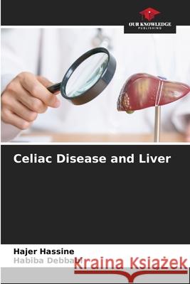 Celiac Disease and Liver Hassine, Hajer, Debbabi, Habiba 9786209131486 Our Knowledge Publishing - książka