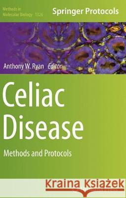 Celiac Disease: Methods and Protocols Ryan, Anthony W. 9781493947751 Humana Press - książka