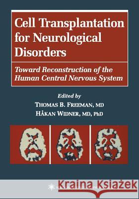 Cell Transplantation for Neurological Disorders: Toward Reconstruction of the Human Central Nervous System Freeman, Thomas B. 9781617370434 Springer - książka