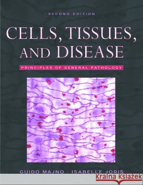 Cells, Tissues, and Disease: Principles of General Pathology Guido Majno Isabelle Joris 9780195140903 Oxford University Press, USA - książka