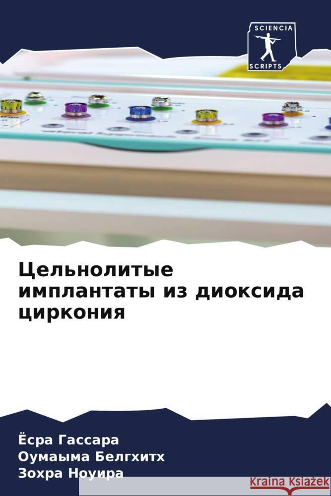 Cel'nolitye implantaty iz dioxida cirkoniq Gassara, Josra, Belghith, Oumayma, Nouira, Zohra 9786208059583 Sciencia Scripts - książka