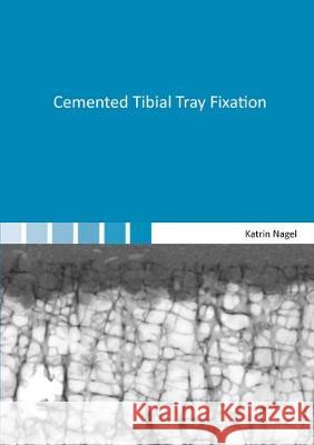 Cemented Tibial Tray Fixation Katrin Nagel 9783844051056 Shaker Verlag GmbH, Germany - książka