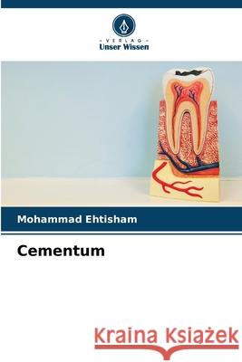 Cementum Ehtisham, Mohammad 9786208778309 Verlag Unser Wissen - książka