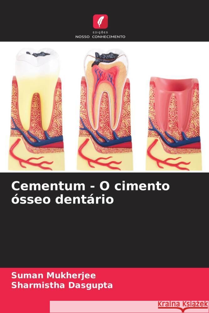 Cementum - O cimento ósseo dentário Mukherjee, Suman, Dasgupta, Sharmistha 9786205465660 Edições Nosso Conhecimento - książka