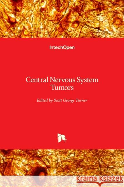 Central Nervous System Tumors Scott Turner 9781839693069 Intechopen - książka