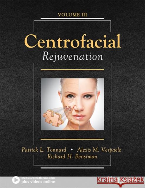 Centrofacial Rejuvenation Tonnard, Patrick 9781626236868 Thieme Medical Publishers - książka