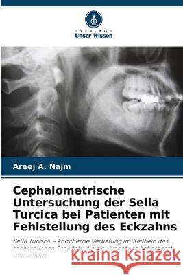 Cephalometrische Untersuchung der Sella Turcica bei Patienten mit Fehlstellung des Eckzahns A. Najm, Areej 9786208817442 Verlag Unser Wissen - książka