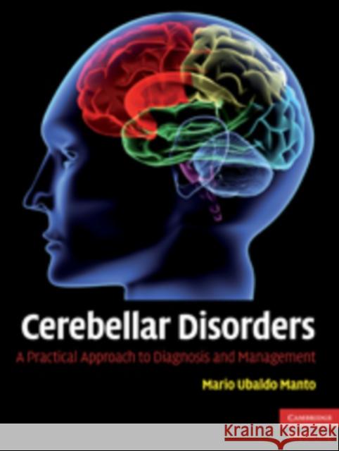 Cerebellar Disorders: A Practical Approach to Diagnosis and Management Manto, Mario Ubaldo 9780521878135  - książka