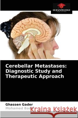 Cerebellar Metastases: Diagnostic Study and Therapeutic Approach Ghassen Gader Mohamed Badri 9786203183627 Our Knowledge Publishing - książka
