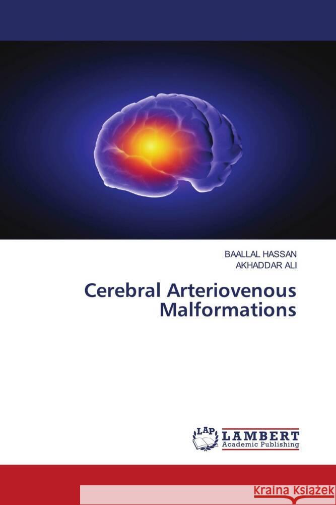 Cerebral Arteriovenous Malformations Hassan, Baallal, Ali, Akhaddar 9786203853599 LAP Lambert Academic Publishing - książka