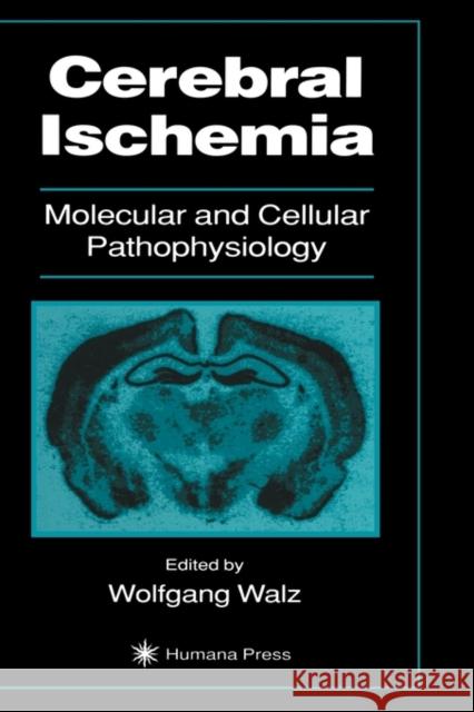 Cerebral Ischemia Walz, Wolfgang 9780896035409 Humana Press - książka